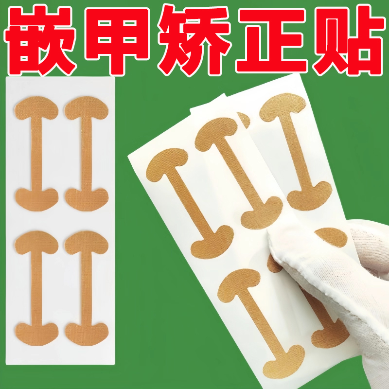 甲沟神器指甲矫正器隔离脚趾甲长肉里填充垫片纠正炎嵌甲专用拉贴