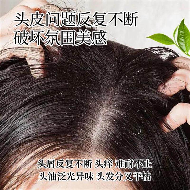 【0硅油0月桂醇】二硫化硒脂溢性清洁头皮去屑止痒控油蓬松洗发水