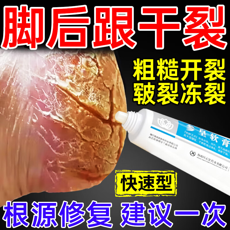 参皇软膏手足干裂脚干裂脱皮真菌感染药膏手脚干裂开裂手足皲裂膏