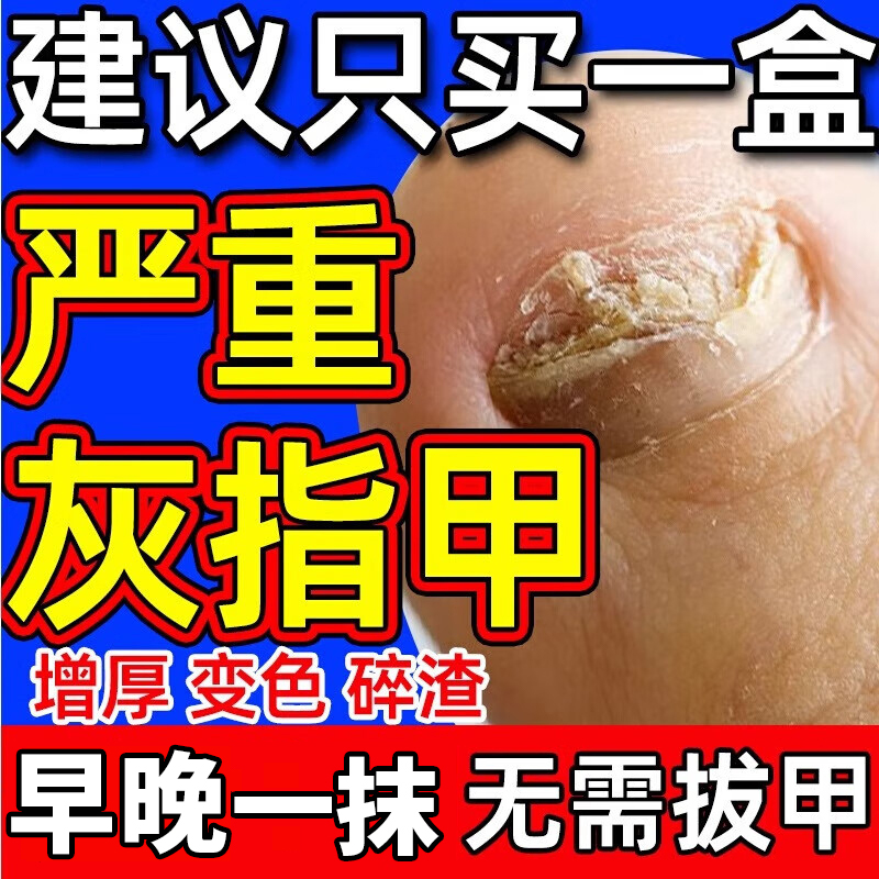 【科田】硝酸咪康唑乳膏2%*20g*1支/盒