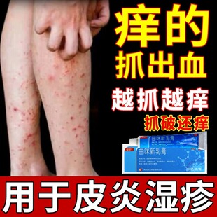 止痒膏药皮肤瘙痒皮炎湿疹真菌皮癣全身止痒抑菌止痒药膏皮肤用药
