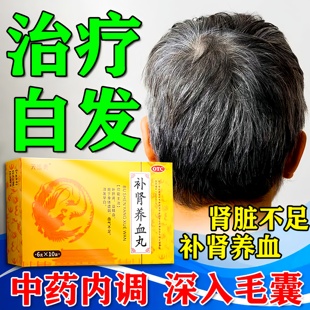 治疗白头发的中成药白发需治发根白转多不黑中药内调服补肾养血丸