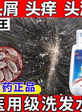康王酮康唑洗剂治头皮屑去头屑药去屑洗头膏止痒洗发水脂溢性皮炎