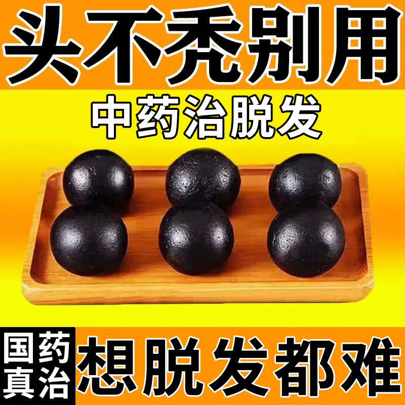 生发丸斑秃治疗药脱发生发掉头发调理肾虚型脱发头发稀固肾生发丸