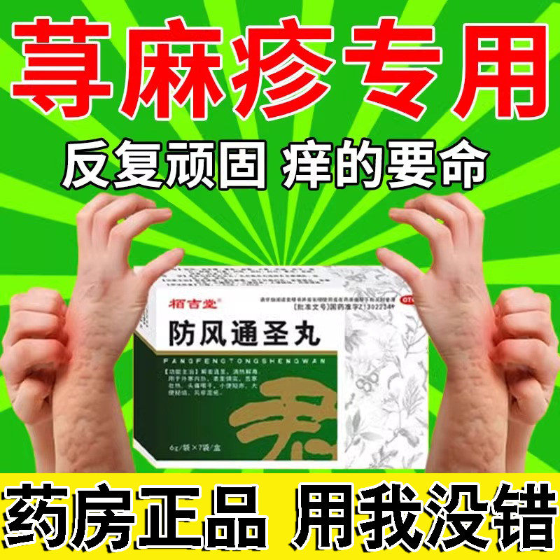 防风通圣丸中药治疗荨麻疹的特止痒效药皮肤瘙痒风团抓痕抗过敏药