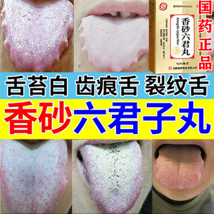 香砂六君丸正品健脾祛湿舌头裂纹齿痕状舌苔黄白厚口臭脾虚湿气重