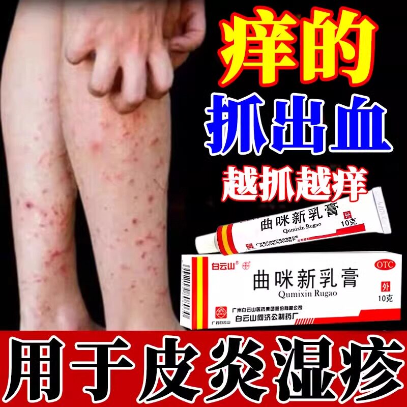 治疗神经性皮炎过敏性皮炎皮肤病湿疹真菌感染红斑红疹止痒