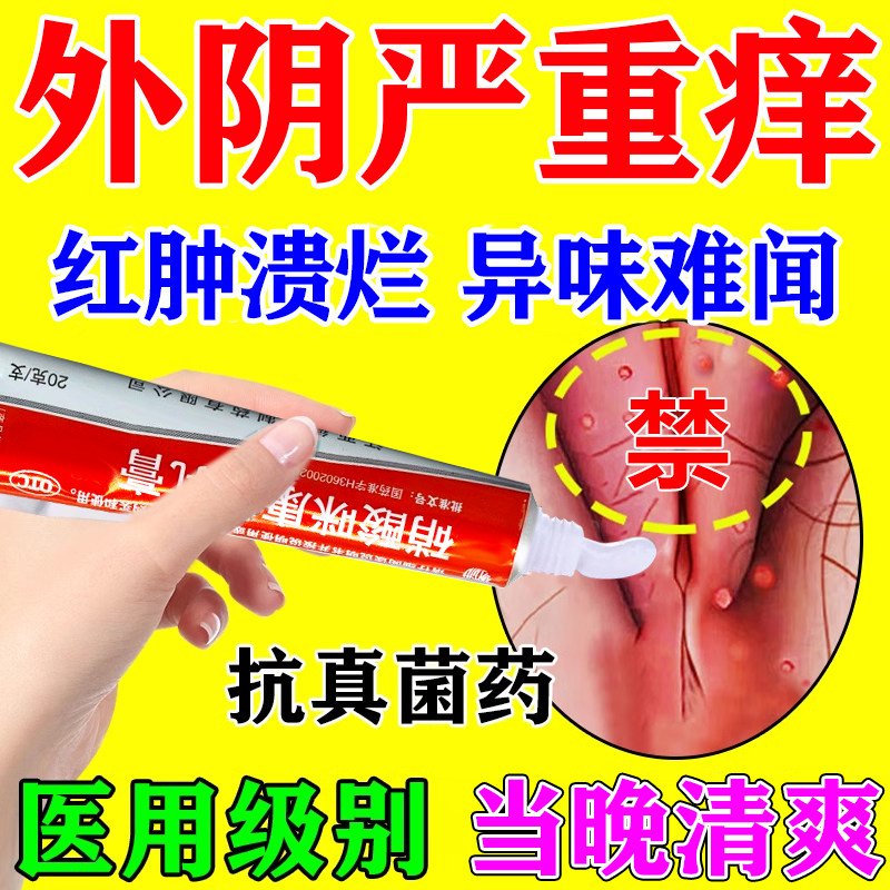 外阴瘙痒止痒抑菌消炎霉菌性阴道炎妇科私处瘙痒红肿专用去药膏根