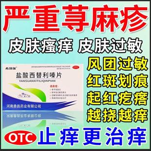 盐酸西左替利嗪片旗舰店治寻荨麻疹过敏止痒断特根痒效专用药止痒