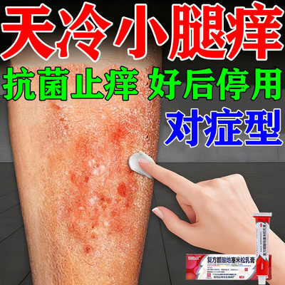 皮肤干燥瘙痒止痒外用的特专用效药膏冬天皮肤干燥瘙痒止痒膏