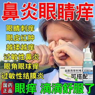 过敏性结膜炎滴眼液鼻炎引起眼睛痒眼角痒干涩消炎杀菌止痒眼药水