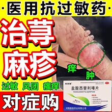 治疗寻荨麻疹过敏性专用药膏专治皮肤痒瘙痒止痒抑菌特慢性效药