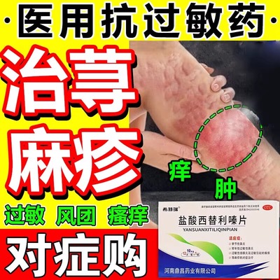 【卓邦】盐酸西替利嗪片10MG*12片/盒