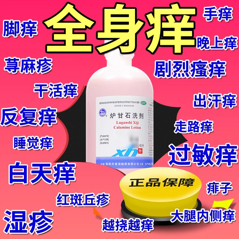【鹏鹞】炉甘石洗剂100ml*1瓶/盒