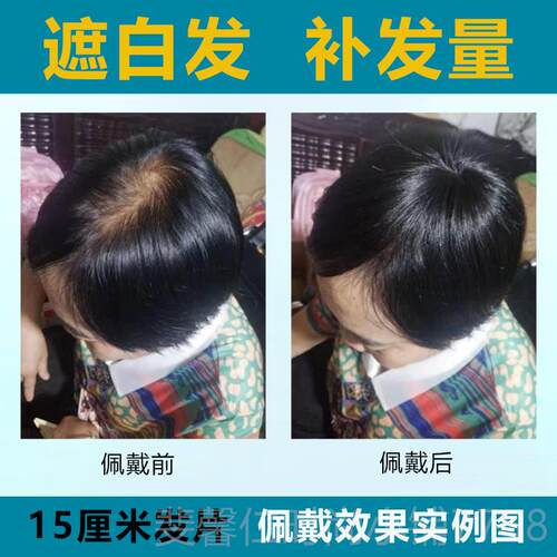 新品头遮白顶发稀少补发假发片发中老年妈直透气短发长发全真人发
