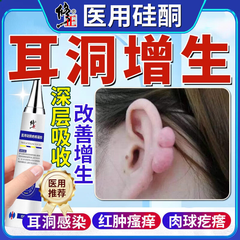 耳洞增生疤痕疙瘩去除红肿瘙痒肉球疙瘩耳洞感染药房同售膏lt