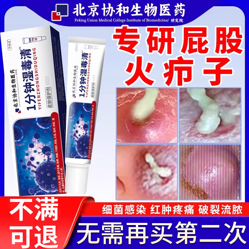 屁股上长火疖子疖肿拔毒膏皮脂腺囊肿拔脓粉瘤去除坐板疮膏kj