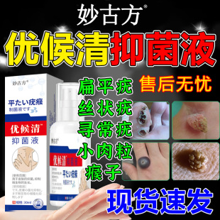 妙古方优候清官方旗舰店抑菌液扁平疣寻常丝状肉粒瘊子喷雾剂正品