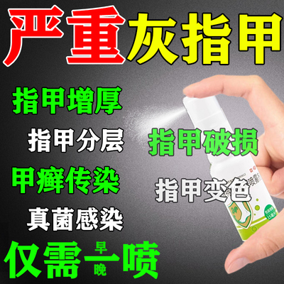正品灰指甲专用药指甲增厚盐酸特比萘芬喷雾剂效抑菌药官方旗舰店