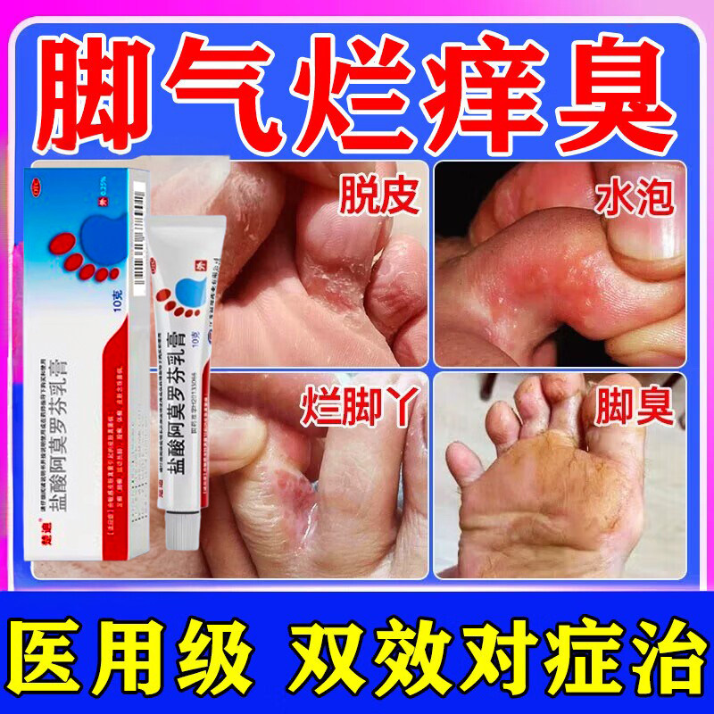 盐酸阿莫罗芬乳膏正品治脚气烂脚丫真脱皮各种癣真菌感染止痒杀菌