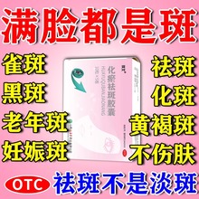 化瘀祛斑胶囊内调祛斑祛黄褐斑雀斑排毒养颜片祛斑专用药官方正品
