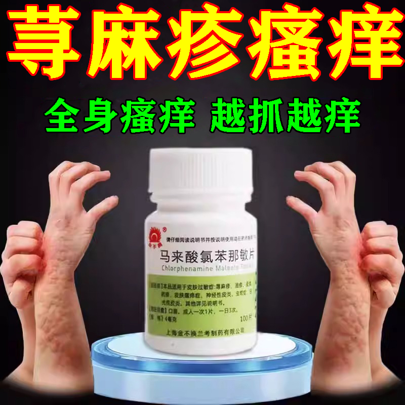 寻荨麻疹过敏止痒专用药