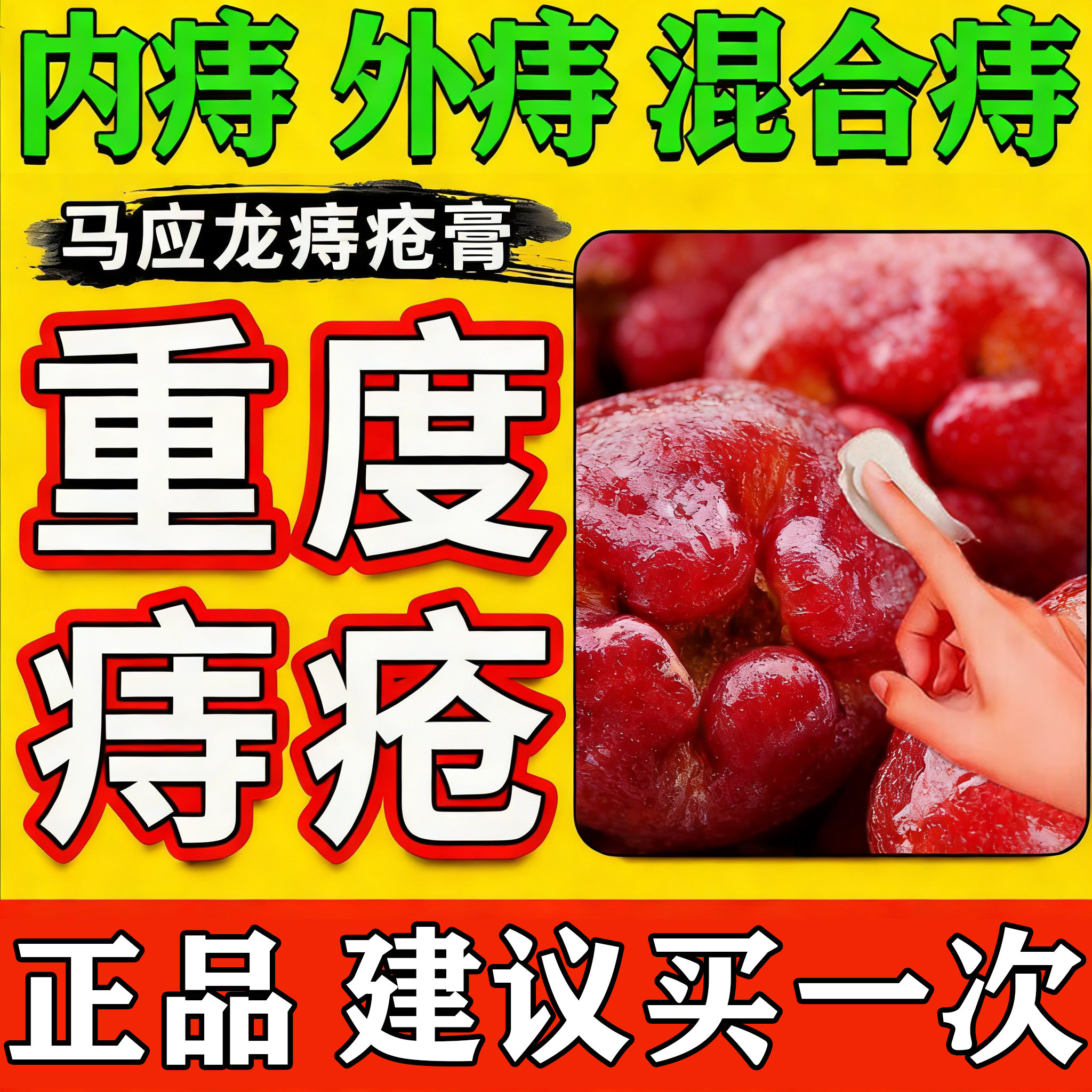 马应龙痔疮膏正品麝香有肉球肛裂大便出血消肿内外痔混合痔旗舰店