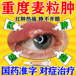 麦粒肿眼药膏消炎药霰粒肿针眼修复盐酸金霉素眼膏官方旗舰店
