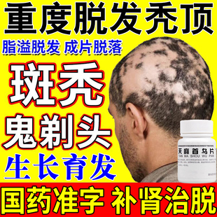 脱发掉头发白发脂溢性脱发男用女性脱发掉发药天麻首乌片官方正品