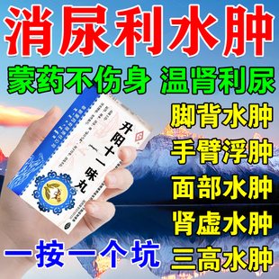 水肿消肿特专用药消水肿新效药利尿消肿下肢腿肿的药升阳十一味丸