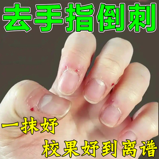 手指倒刺营养油儿童指甲边缘倒刺修复护理防起皮防倒刺修复神器