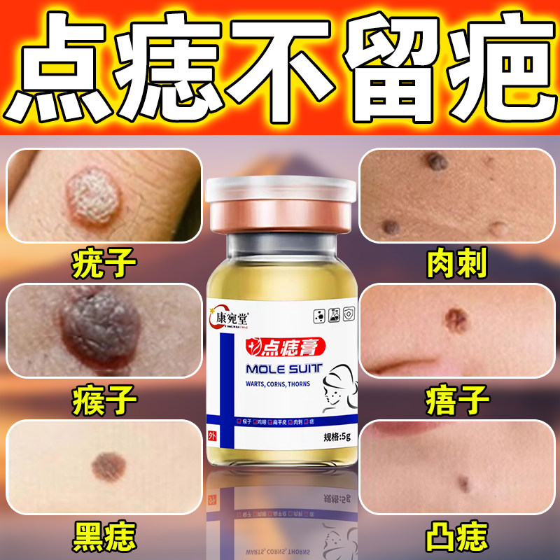 点痣膏无痕正品旗舰店去除脸上痦子黑点肉刺凸痣肉痣点斑水不留疤