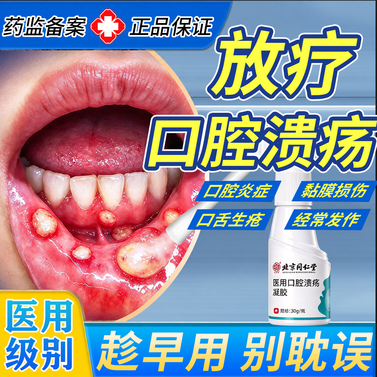 北京同仁堂放疗化疗后用口腔溃疡口腔黏膜炎口舌生疮疼黏膜修复剂
