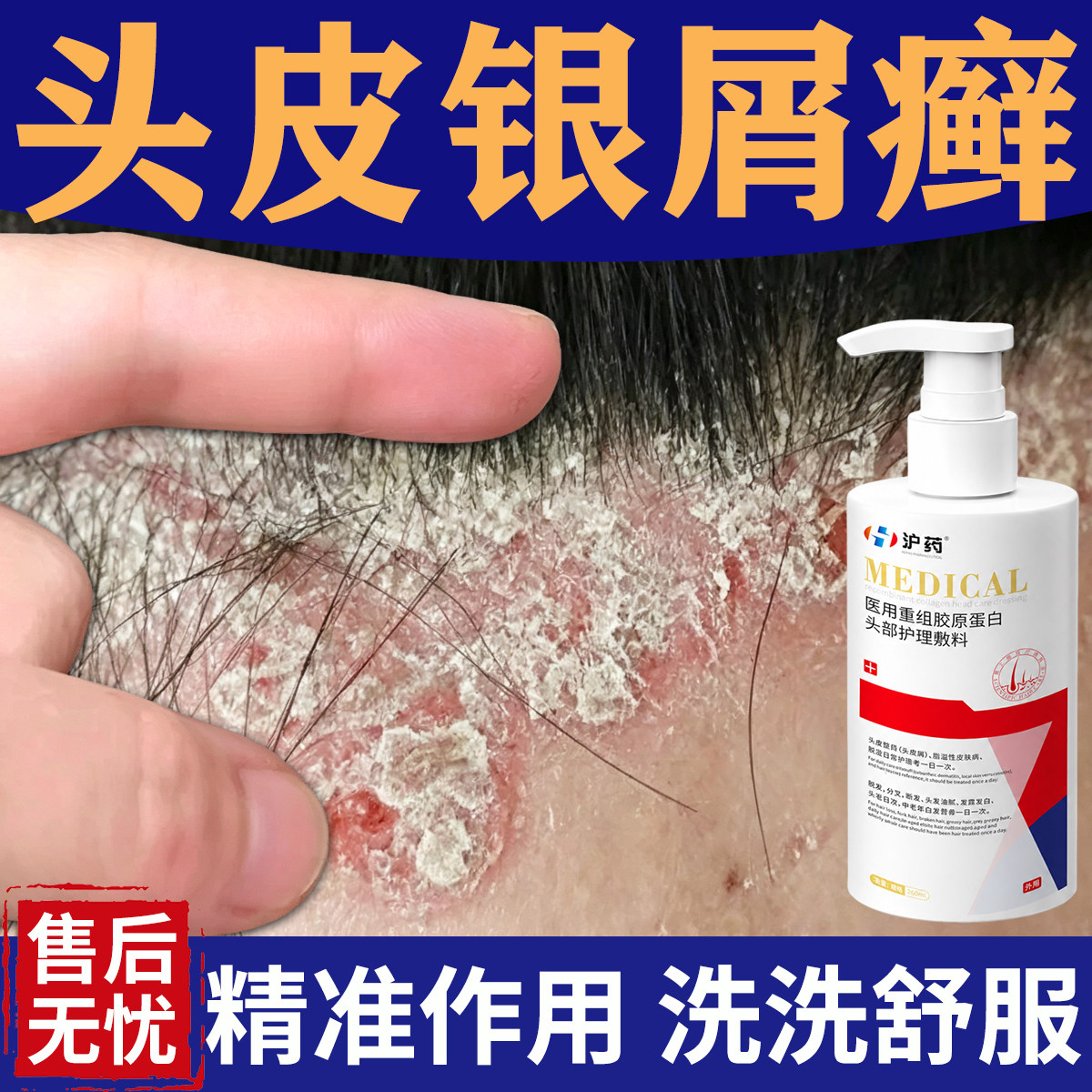 银屑病专用洗发水头脂溢性皮炎皮癣真菌感染头屑头痒头皮止痒喷剂