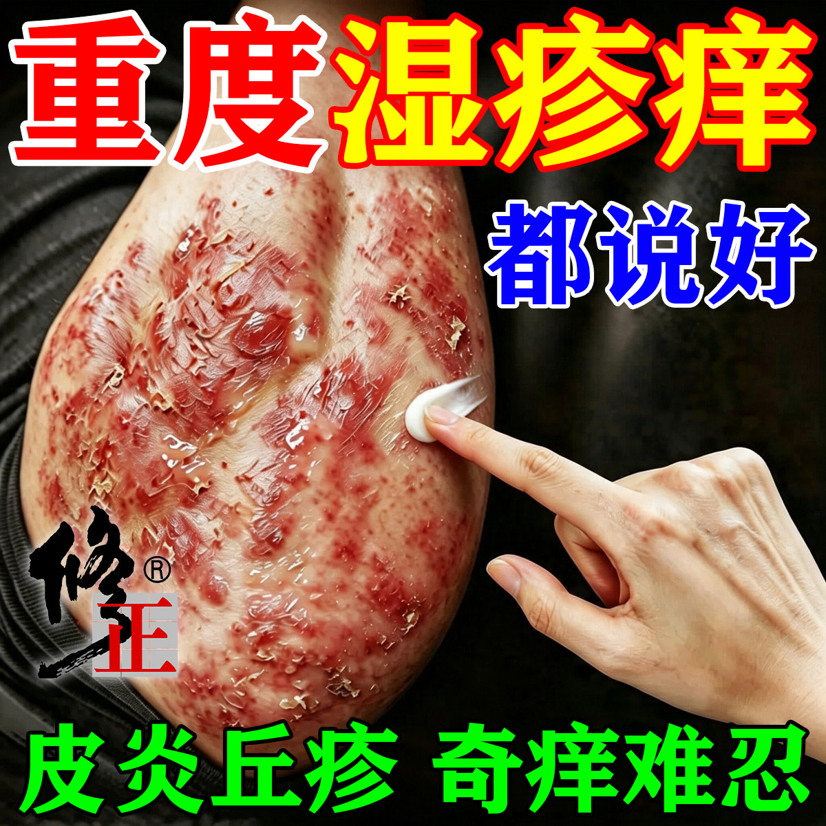 湿疹止痒专用慢性皮炎热毒角化型阴囊私处湿疹癣皮肤瘙痒抑菌软膏