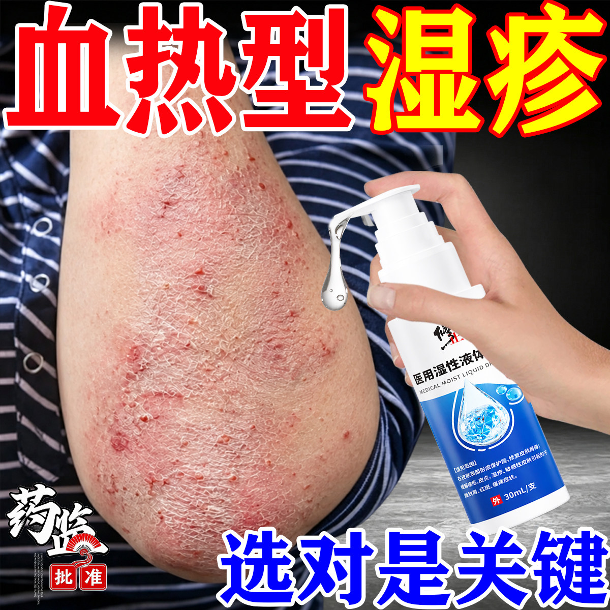 血热型湿疹真菌感染皮肤剧烈痒红斑丘疹热毒湿疹顽固皮炎医用凝胶