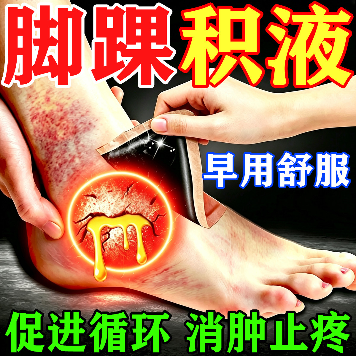 脚踝积液膏药脚踝扭伤关节疼肿痛胀滑膜炎专用韧带损伤撕裂消肿贴