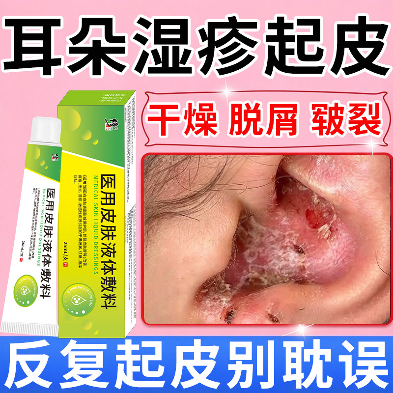 外耳道湿疹膏耳朵起皮湿疹痒干燥脱皮脂溢性皮炎真菌感染耳根裂口