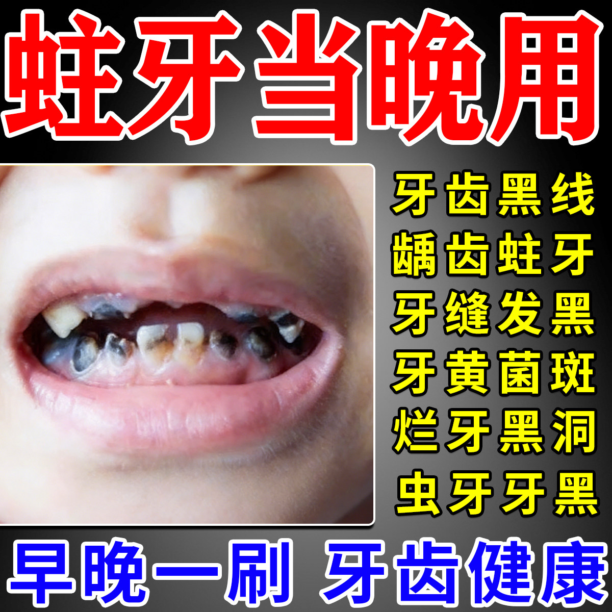 牙I膏防蛀牙龋齿修复烂牙牙菌斑虫牙烂牙清理黑线黑渍含氟儿童用,医疗器械,牙齿防龋/脱敏类,淘宝优惠券,粉丝福利购,淘宝优惠卷