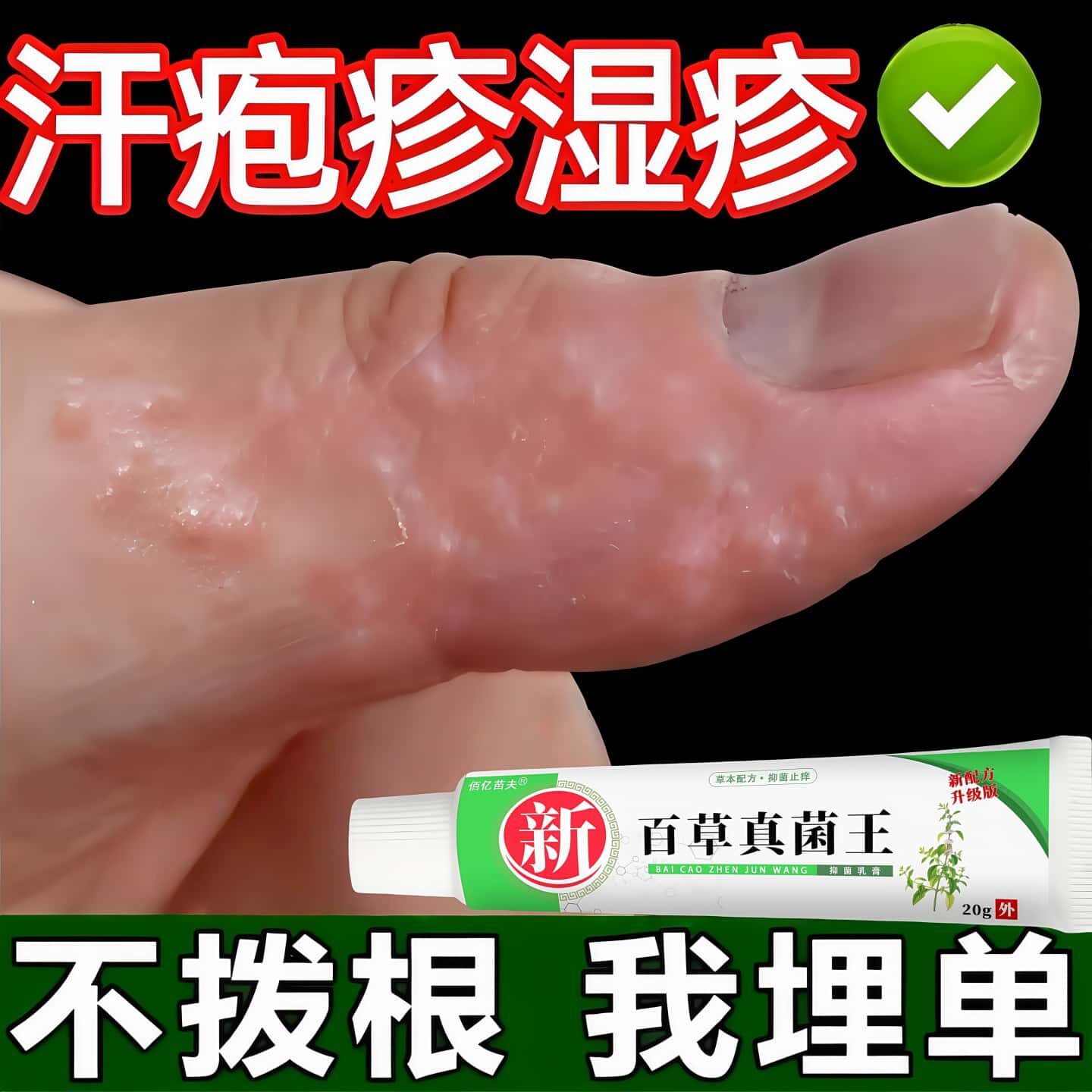 手上起小水泡汗状疹止疱汉状真感专菌手气非疹痒脱皮染湿用软膏药图片