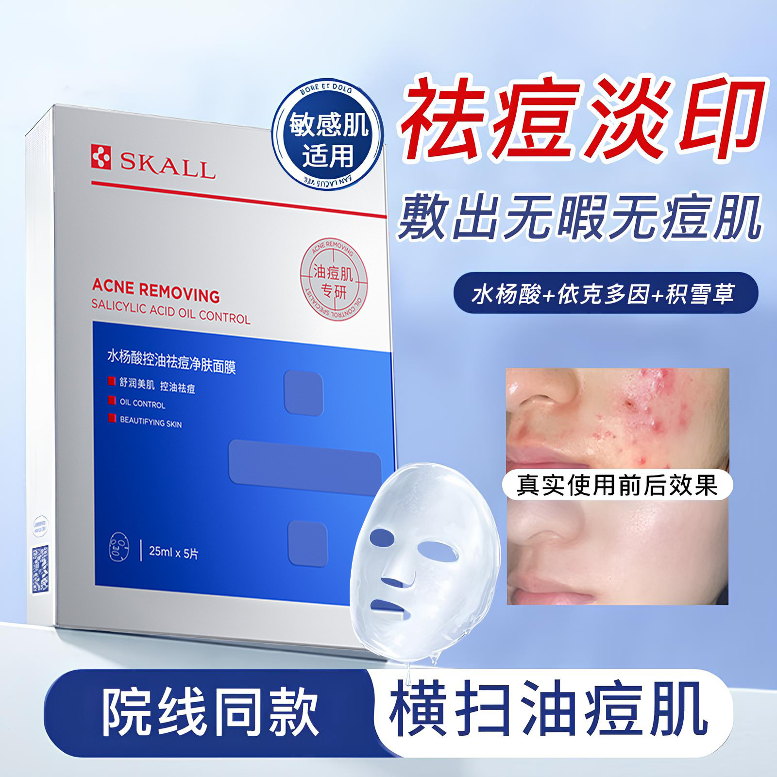 水杨酸祛痘面膜控油淡化痘印