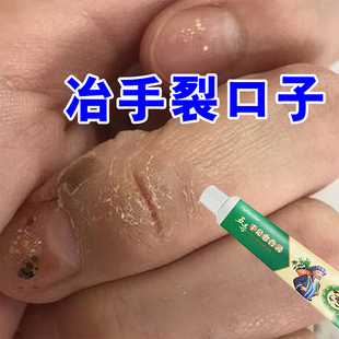 手裂口干裂修复霜秋冬季指甲缝干裂手指脱皮开裂手足干裂防裂膏