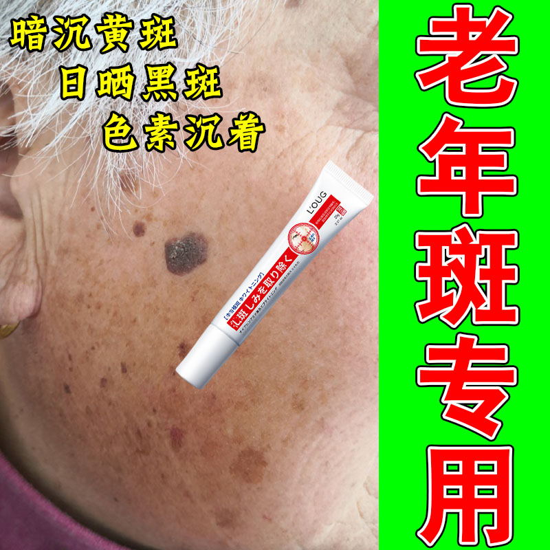 老人斑老年黑黄色斑点斑黄斑手部脸部皮肤暗沉修护白均匀膏乳