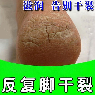 脚后跟干裂修复霜脱皮粗糙干燥保湿修复脚裂脚跟裂口手脚脱皮软膏