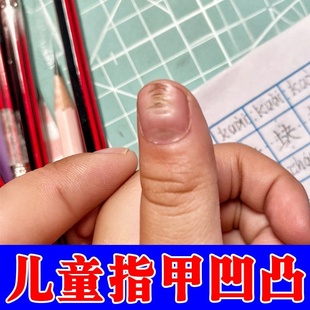 脚指甲凹凸不平修复液受损变形坑坑洼洼开裂分层萎缩甲床修复再生