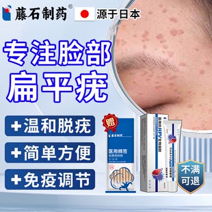 扁平疣去除膏去疣瘊小肉粒面部脸上去疣专用软膏日本监制一抹灵XP
