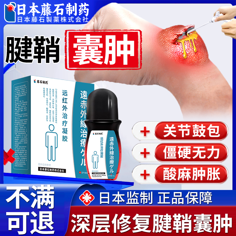 【不满可退】囊肿当晚消