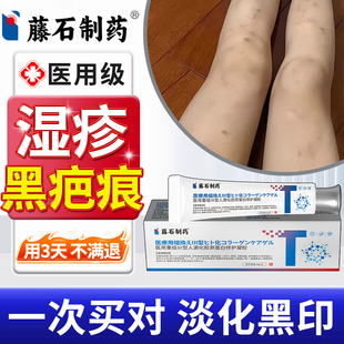湿疹疤痕黑色素沉淀祛去蚊虫叮咬疤痕淡化湿疹黑印修复皮肤膏XP