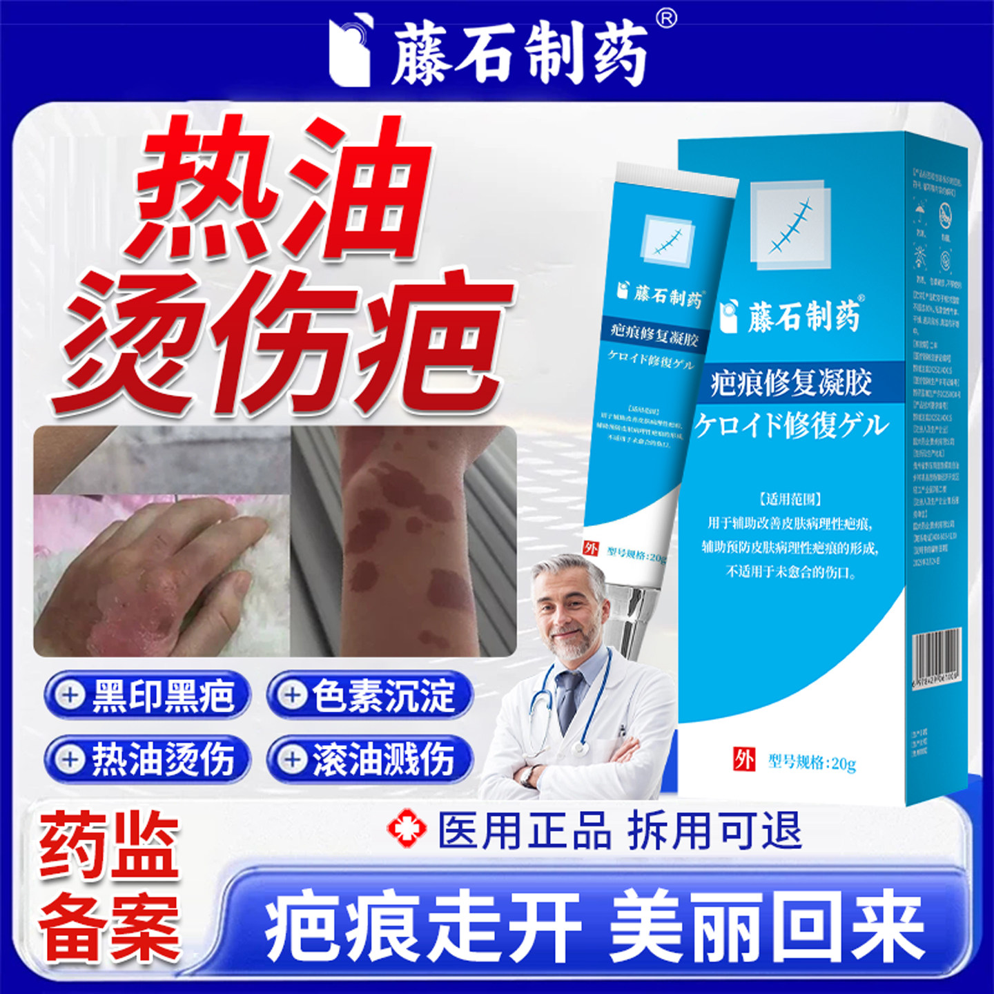 烧伤烫伤医用硅酮祛疤凝胶疤痕修复除疤膏去黑印色素沉淀淡化膏XP