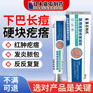 下巴反复长痘内调搭膏药贴姨妈硬块痘痘疙瘩脓包痤疮搭火疖子膏YK